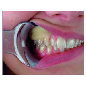 Reso-Pac HAGER & WERKEN - Unidoses de 2g - Bote de 50