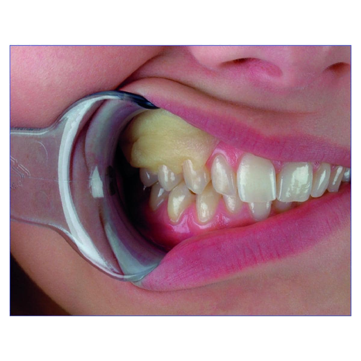 Reso-Pac HAGER & WERKEN - Unidoses de 2g - Bote de 50