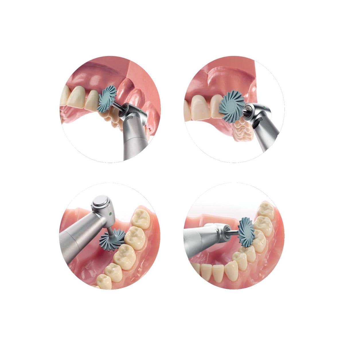 Shapeguard DIATECH - Kit d'essai Zircone
