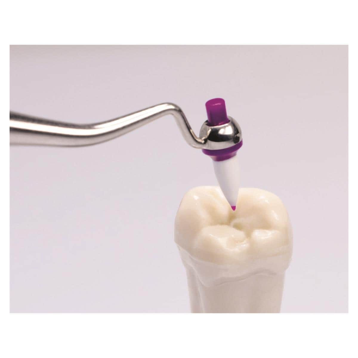 OPTRASCULPT RECHARGE POINTE (60) IVOCLAR
