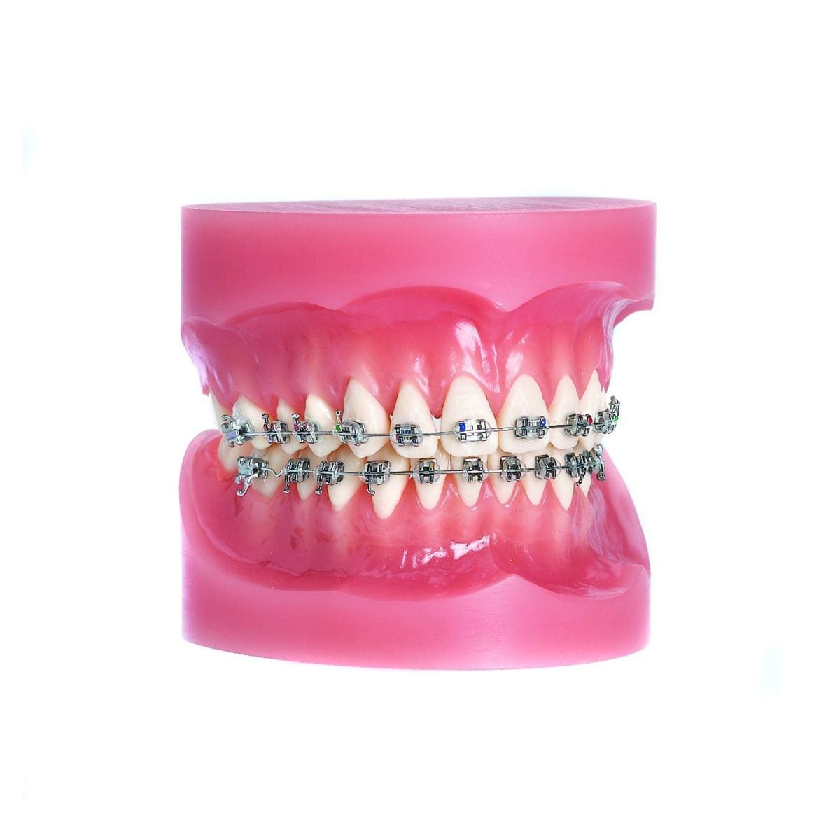 Bracket Soltice MASEL - Maxillaire Centrale - 0,018 - Droite - Bote de 10