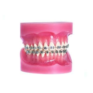 Bracket Soltice MASEL - Maxillaire Centrale - 0,018 - Droite - Bote de 10