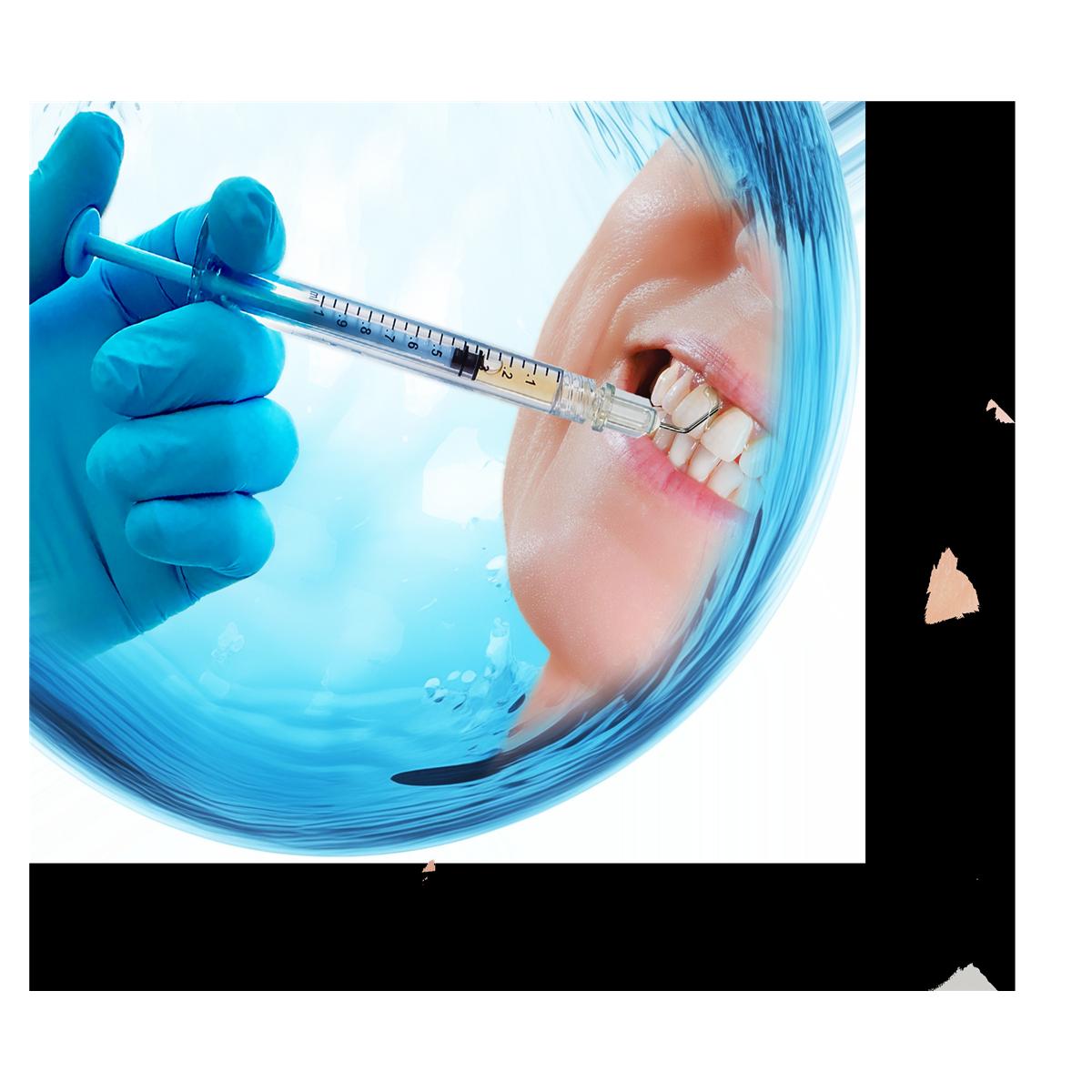 Sterify Gel - 1 seringue - 0.3mL - HU FRIEDY