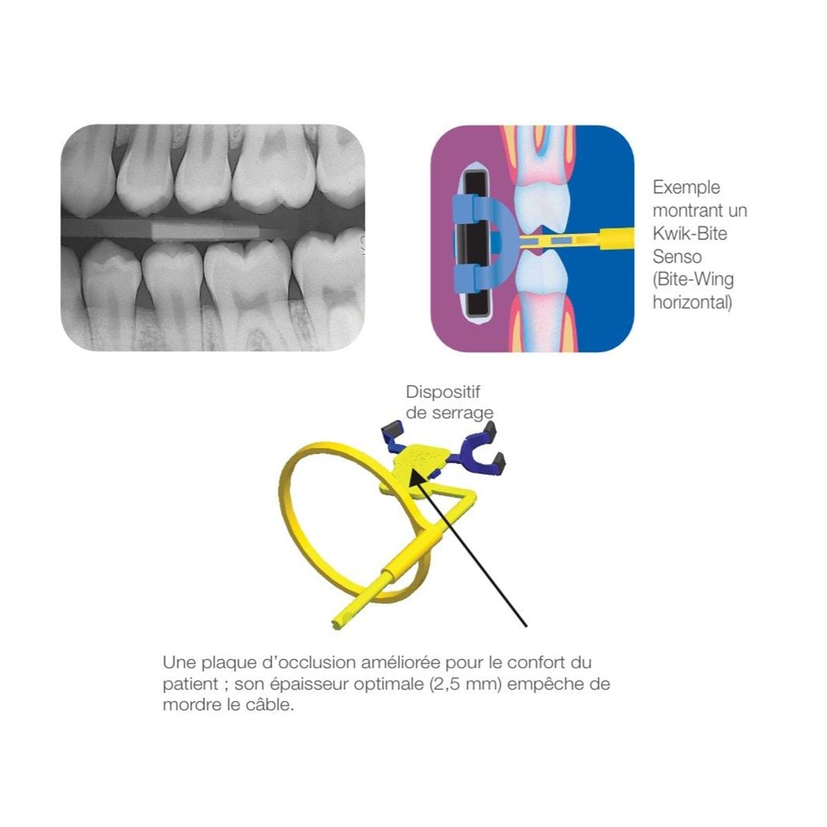 Kwik Bite Senso KERR - Coffret Angulateur