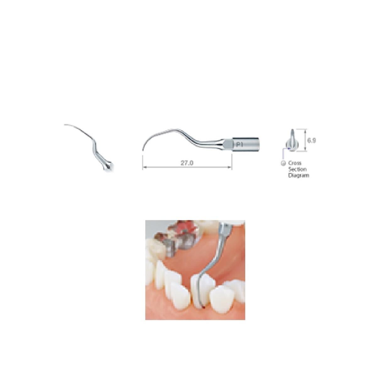 Insert Perio P1 Z217-404 Nsk
