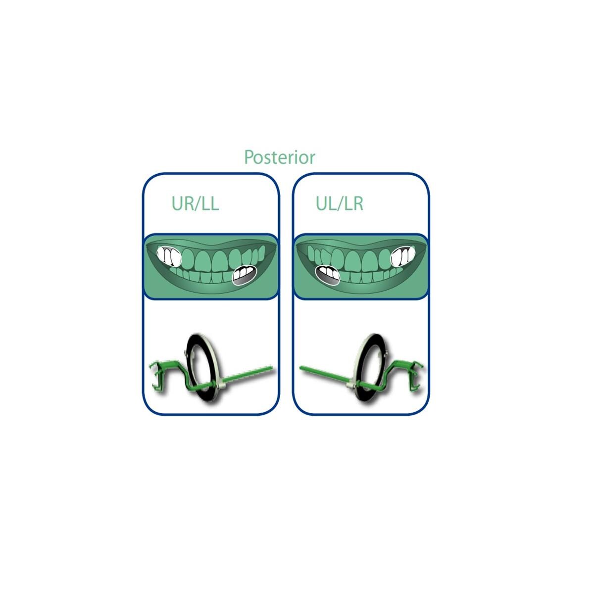 Angulateurs Opteo OWANDY - Taille 2 Postrieur - vert - Coffret de 10 recharges