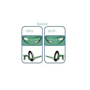 Angulateurs Opteo OWANDY - Taille 2 Postrieur - vert - Coffret de 10 recharges