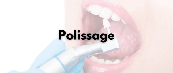 Polissage